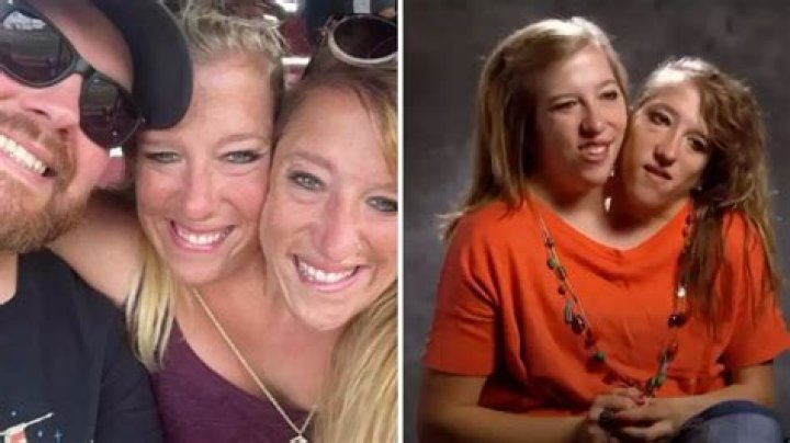 Abby And Brittany Hensel Pregnant Shea Willie
