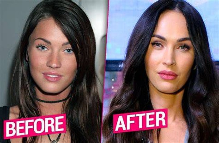 Megan Fox Plastic Surgery Has the Actress Gone Under the Knife?