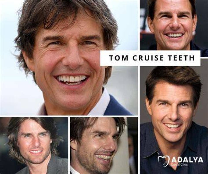 The Shocking Truth: Tom Cruise's Dental Disasters