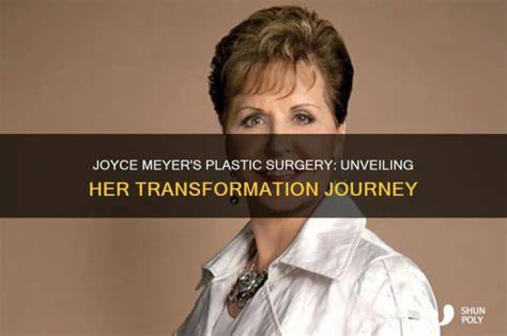 Unveiling Joyce Meyer's True Face: Before The Knife